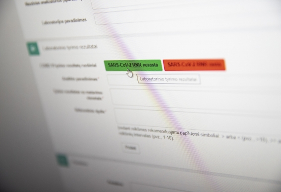 NVI laboratorijoje ištirta jau daugiau kaip 13 tūkst. koronaviruso mėginių